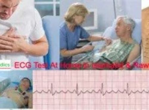 ECG Test At Home in Islamabad & Rawalpindi